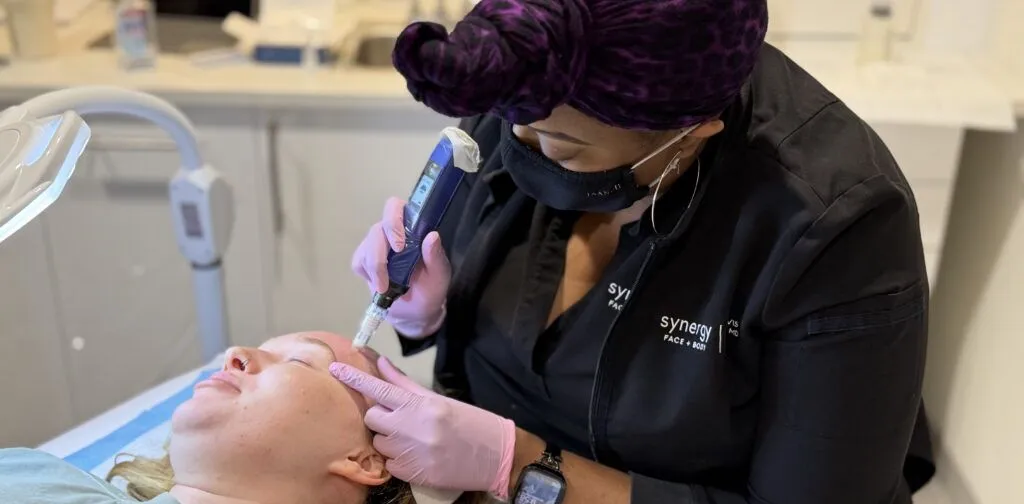 How Long Does Microneedling Last? 