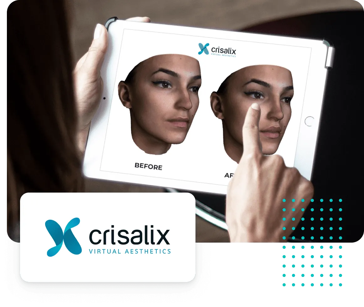 Discover Your Future Self with Crisalix 3D Simulation: Visualize the Beautiful Possibilities of Plastic Surgery