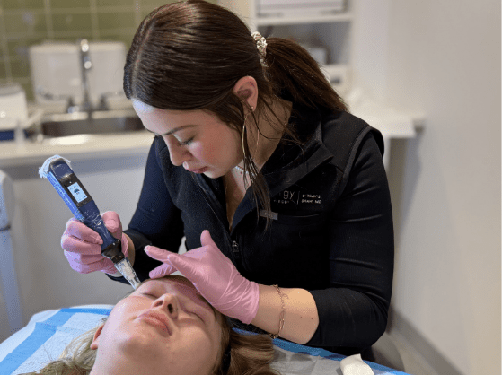 Microneedling