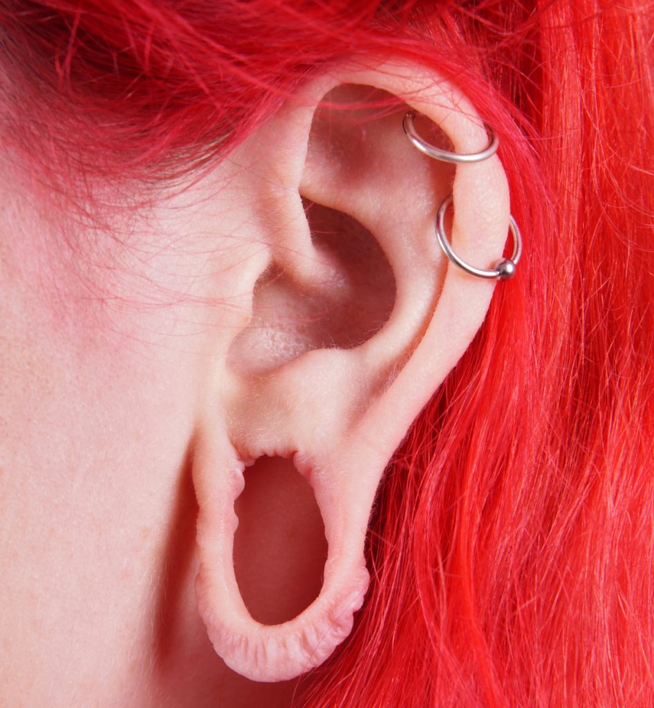 Earlobe damage
