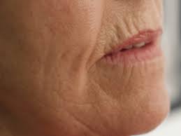 photo of a woman's wrinkled lips