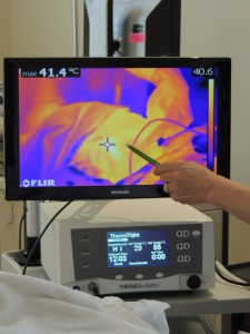 thermismooth infrared camera monitor showing heat energy delivery