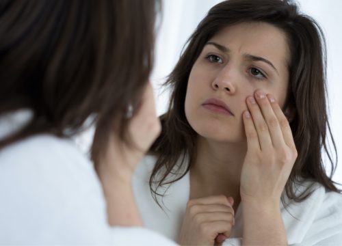 Woman with under-eye bags