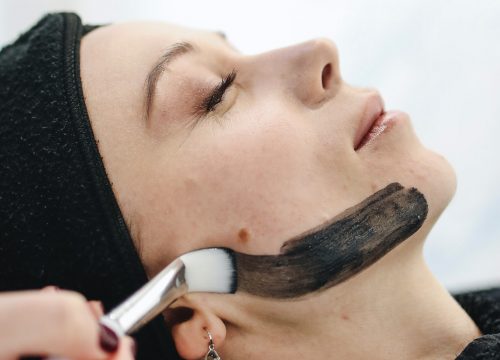 Woman receiving a carbon laser facial