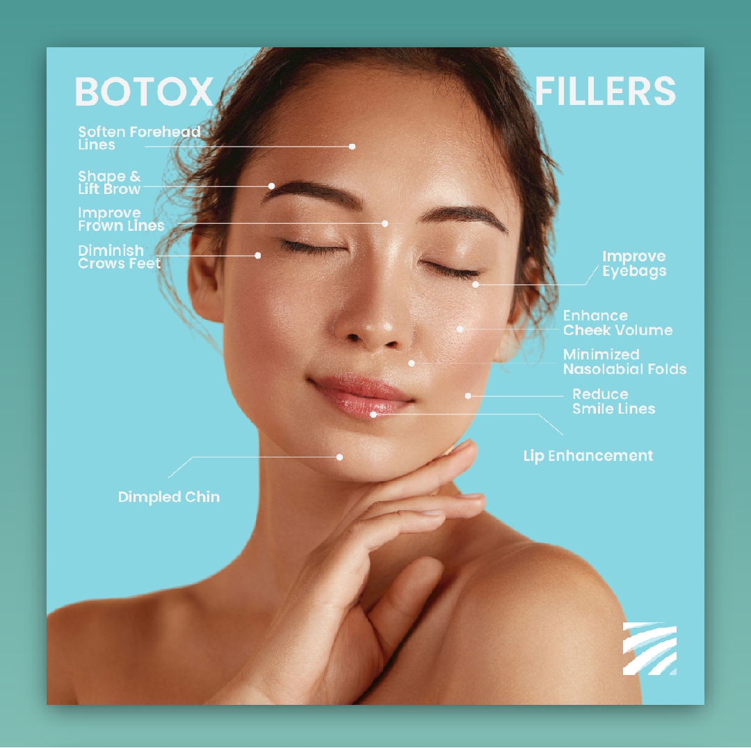 Botox vs. fillers