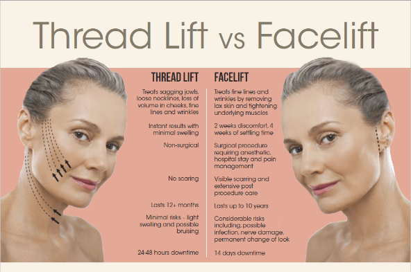 Thread Lift vs. Face Lift